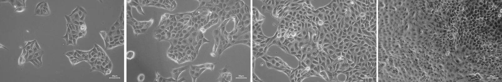Example cell microscopy images at different confluence levels